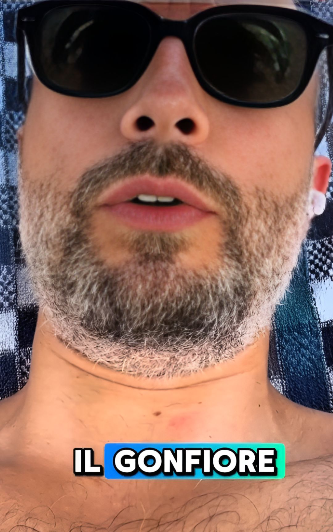 Meduse, i 3 passaggi da seguire dopo una puntura