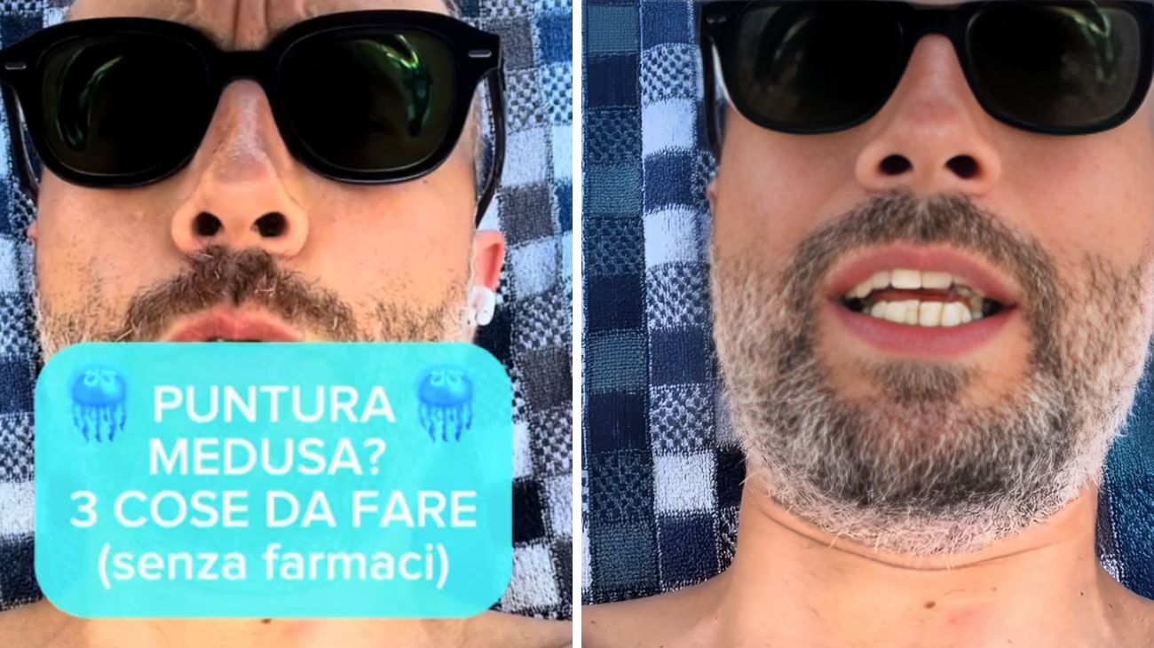 Meduse, quali sono i rimedi contro le punture