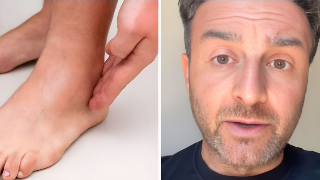 Caviglie gambe gonfie consigli alimentari