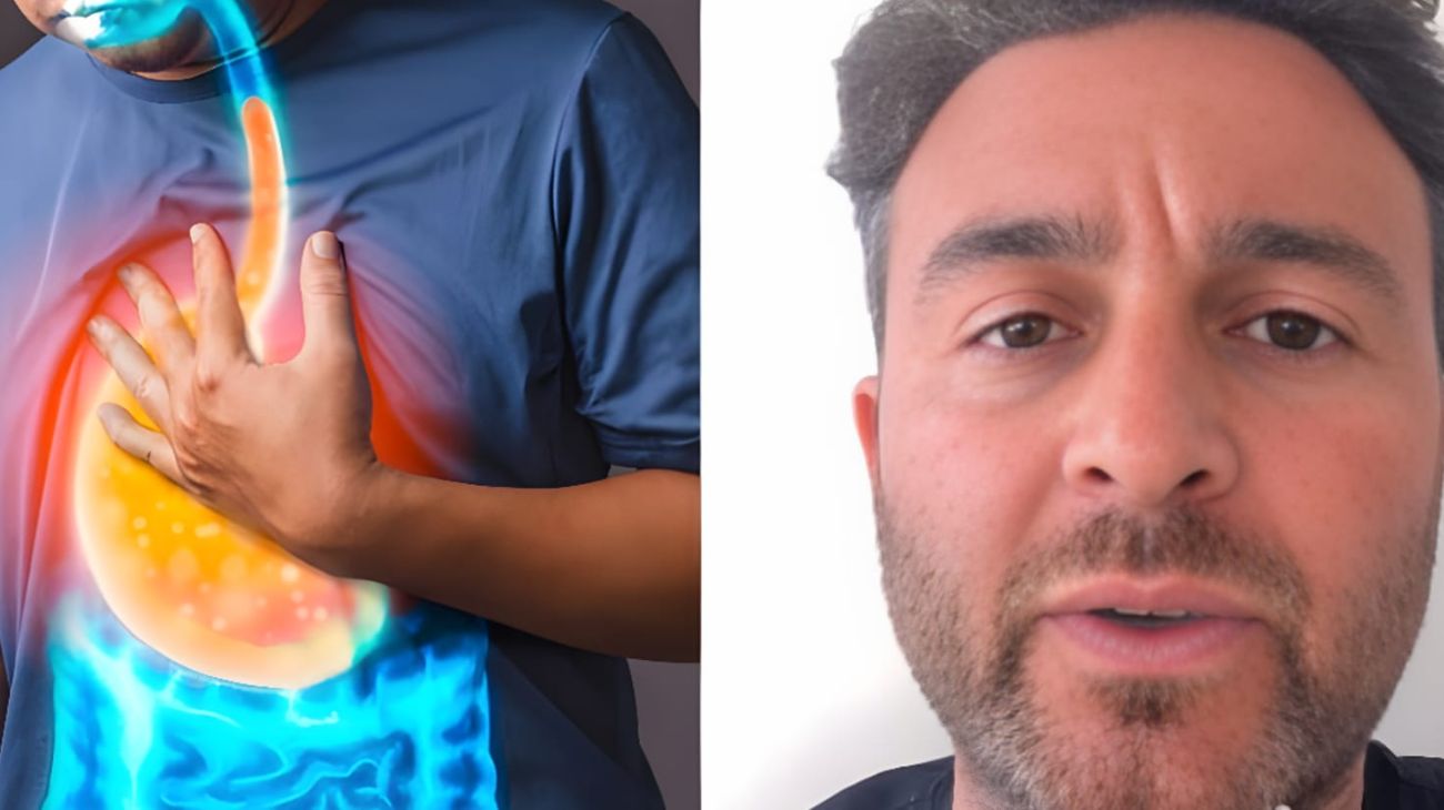 Reflusso gastroesofageo due cotture