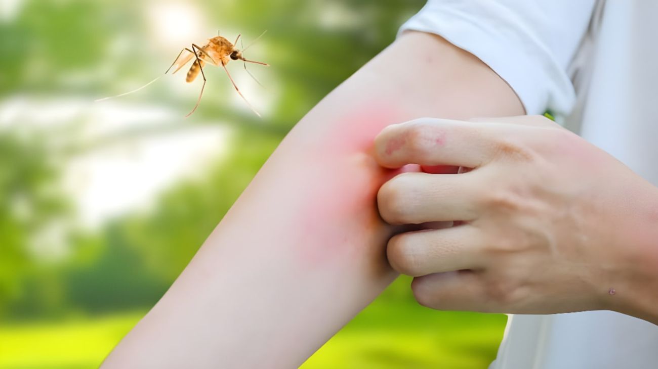 Zanzare addio: l'eucalipto è il rimedio ideale