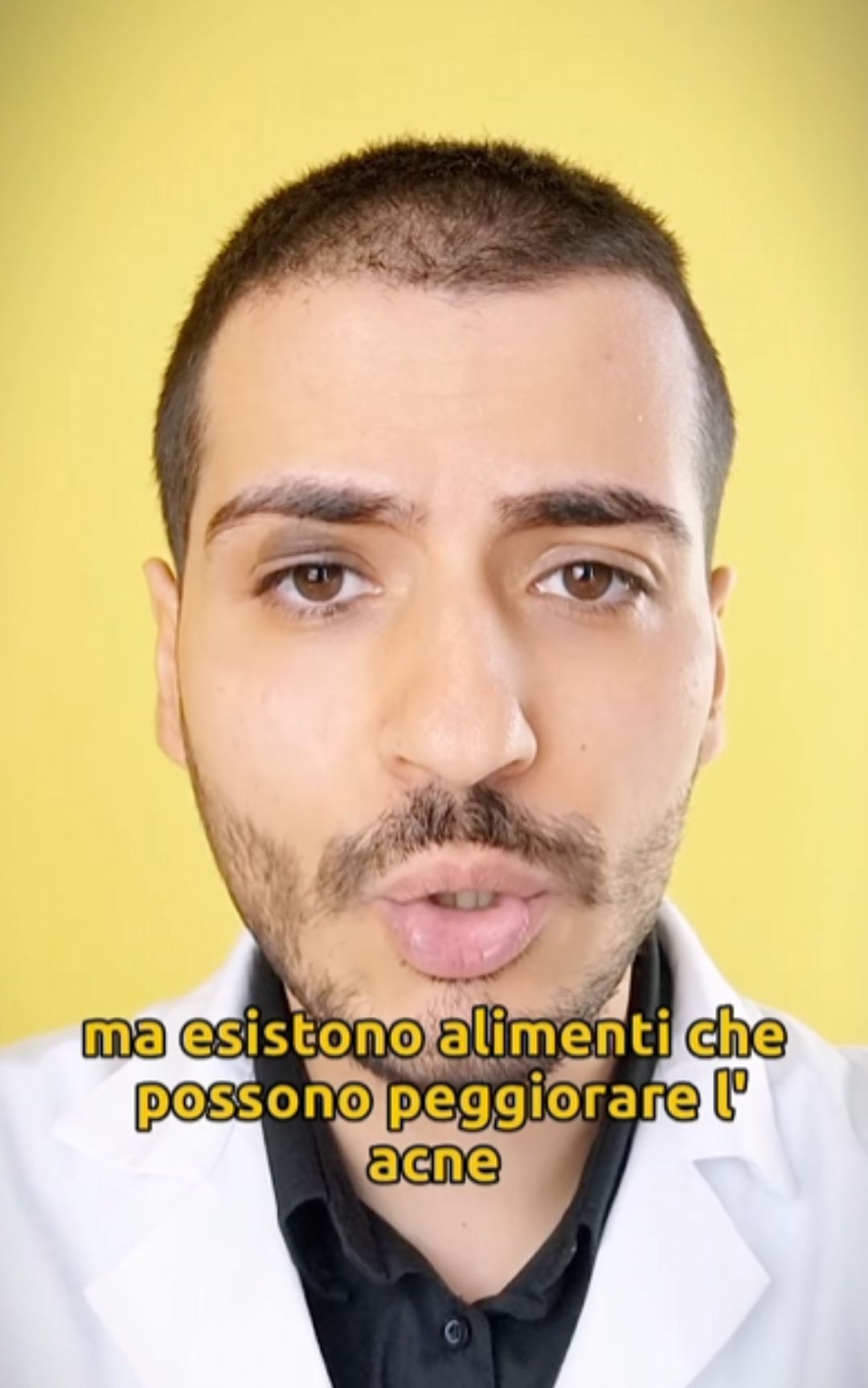 Anche, non solo cioccolato: quali alimenti peggiorano la condizione