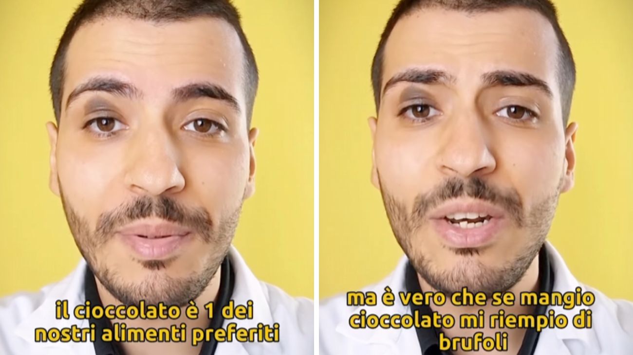 Cioccolato, è vero che fa crescere i brufoli?