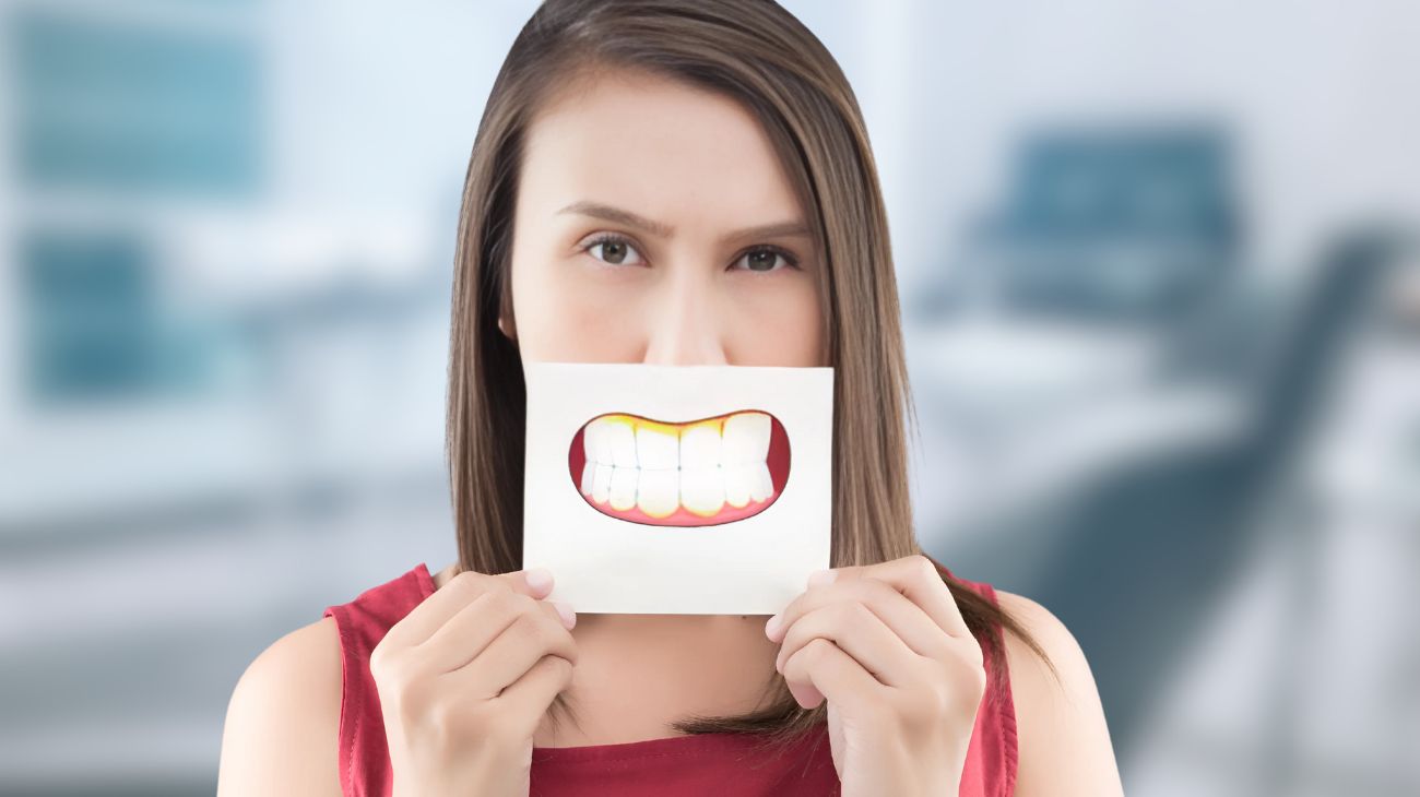 Igiene dentale tartaro